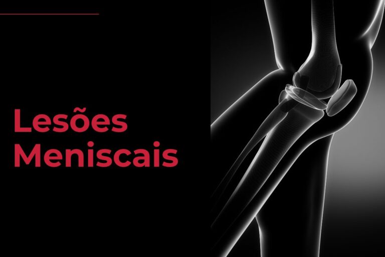 Lesões Meniscais